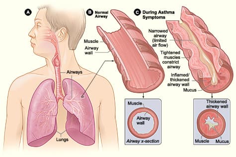 Asthma Clinic