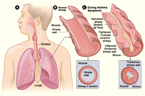 Asthma Clinic
